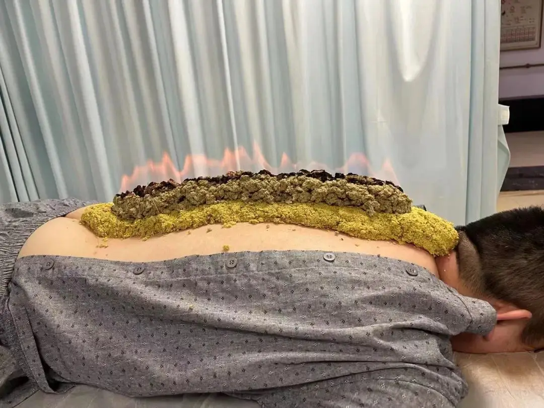 督脉灸：点燃身体的阳气之火