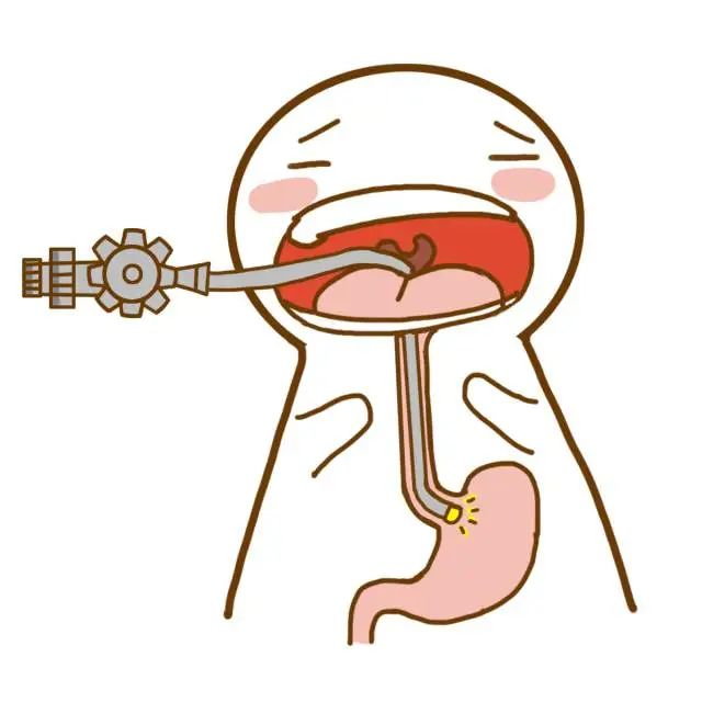 无痛胃肠镜检查让你不再“谈镜色变”，轻松告别“畏”镜心理