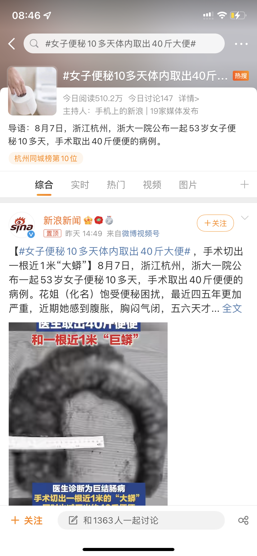 女子便秘10余天，体内取出40斤大便，警钟再次敲响：便秘危害重重，调理是关键！